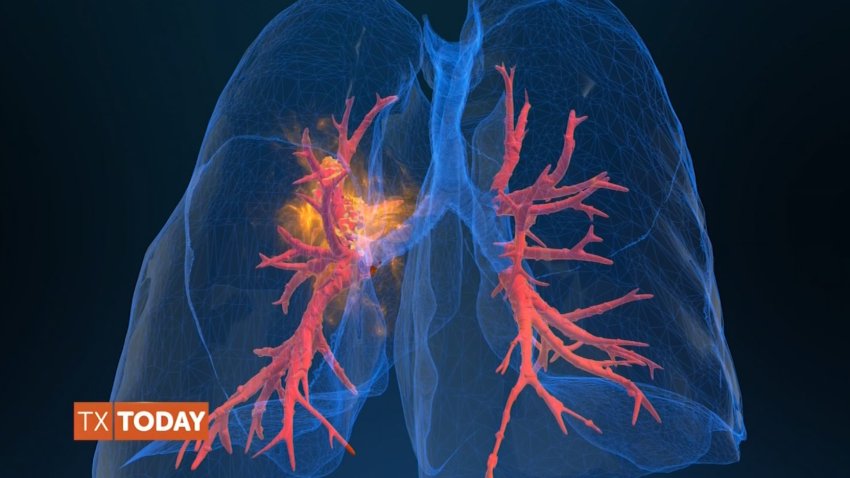 Lifesaving Knowledge From Advanced Body Scan – SPONSORED