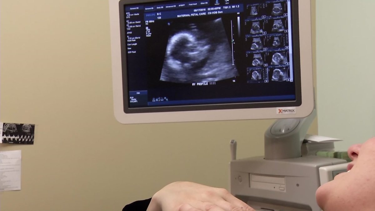 Getting the Message Out Baby Aspirin May Prevent Preeclampsia NBC 5