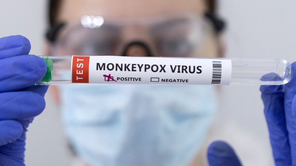 How to Protect Yourself Against Monkeypox and What to Do If You Catch It - Vimarsana News