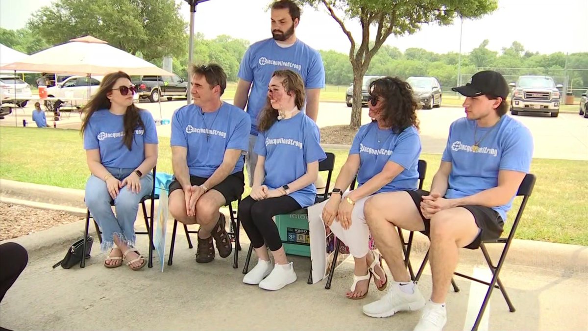 Coppell Holds Fundraiser For North Texas College Student Mauled By Dogs - Vimarsana News