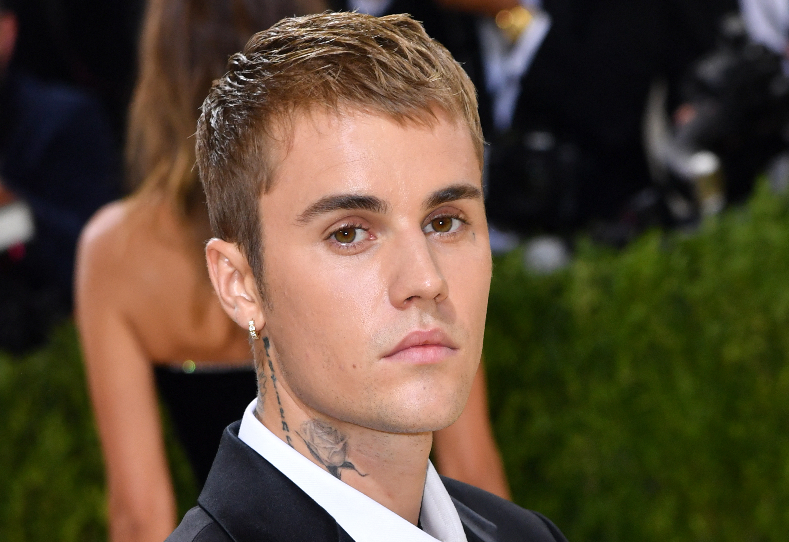 Justin Bieber Diagnosed with Ramsay Hunt Syndrome, Partially Paralyzed – NBC 5 Dallas-Fort Worth - Vimarsana News
