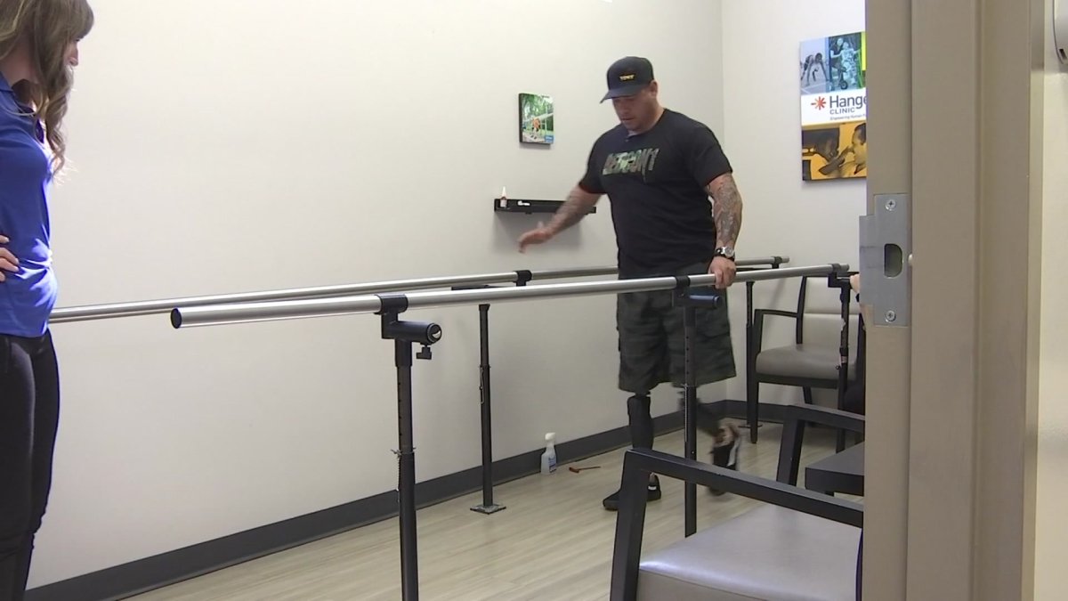 Cape Coral company offers prosthetic legs to double amputee