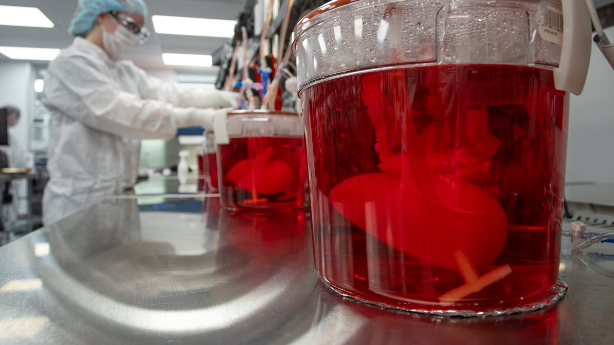 Scientists Seek to Use Pig Livers to Ease Organ Shortage – NBC 5 Dallas-Fort Worth - Vimarsana News