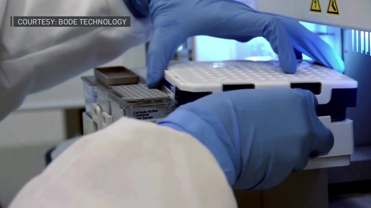 Dallas Police Work to Process Backlogged Assault Kits – NBC 5 Dallas-Fort Worth - Vimarsana News