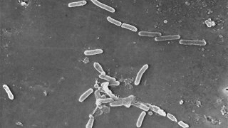 FILE – This scanning electron microscope image made available by the Centers for Disease Control and Prevention shows rod-shaped Pseudomonas aeruginosa bacteria.