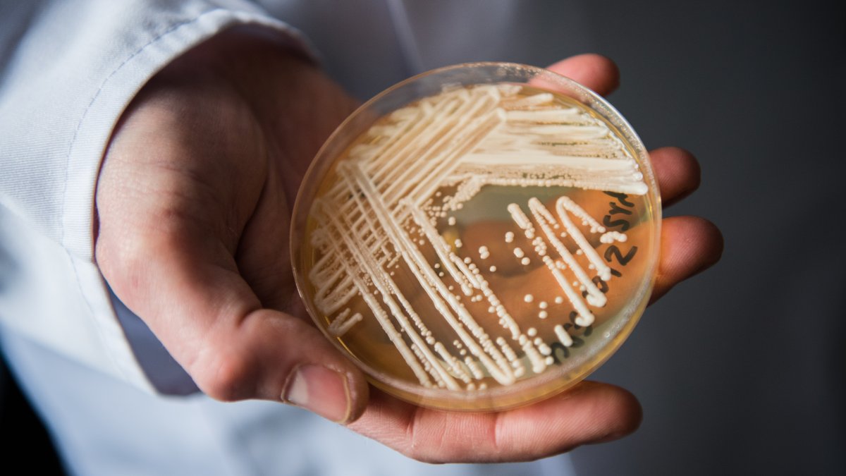 Deadly Fungal Infection Spreading at an Alarming Rate, CDC Says - NBC 5 Dallas-Fort Worth : The fungus, a type of yeast called Candida auris, or C. auris, can cause severe illness in people with weakened immune systems.  | Tranquility 國際社群