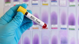 Blood sample for respiratory syncytial virus (RSV) test