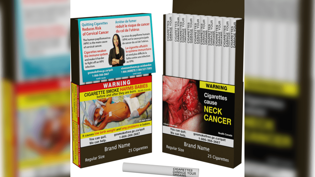 Canada Unveils World's First Individual Cigarette Warning Labels – NBC 5 Dallas-Fort Worth - Vimarsana News