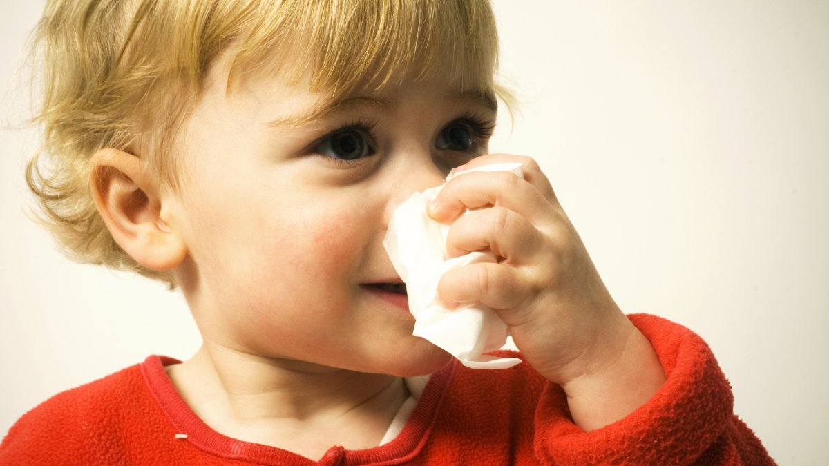 Babies with eczema could go on to develop food allergies, asthma and hay fever in that order