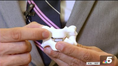 How cervical disk replacement can save necks and relieve pain