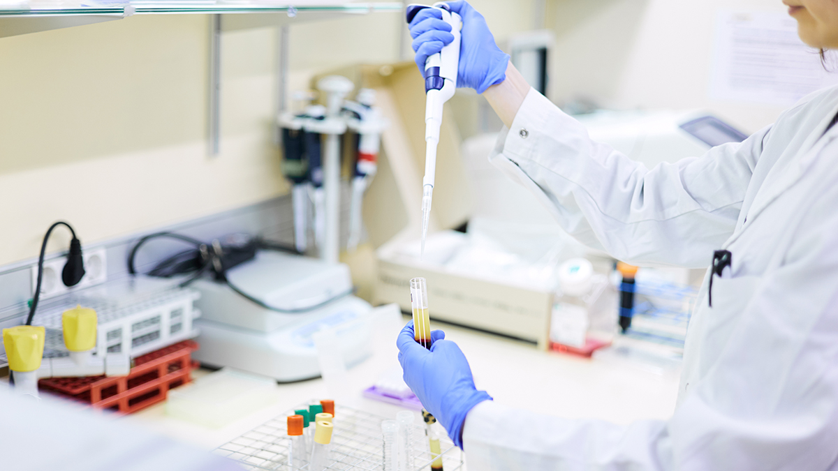 A blood test for long COVID is possible, a study suggests