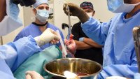 Surgeons perform second pig heart transplant, trying to save a dying man