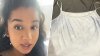 Woman's sweat turned blue during pregnancy: ‘I thought I was becoming an Avatar'
