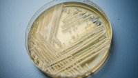 Washington state faces first outbreak of a deadly fungal infection that's on the rise in the US