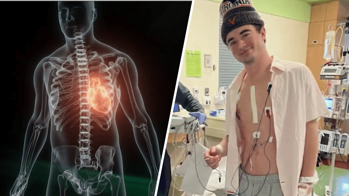 'Don't ignore it': Doctor shares warning signs after Virginia college athlete sidelined by heart condition