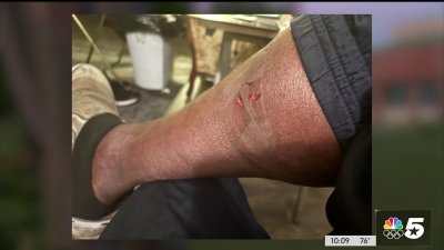 Man seeks city's help after he claims he was attacked by a dog