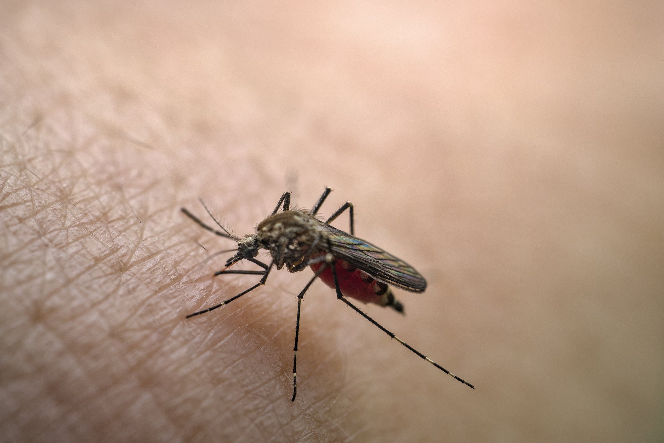 Dengue fever, once confined to the tropics, now threatens the US - Vimarsana News
