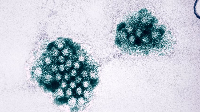 An Electron Micrograph Of The Norovirus, With 27 32Nm Sized Viral Particles. Norwalk Viruses And Related Caliciviruses Are Important Causes Of Nonbacterial Gastroenteritis In The United States. An Estimated 181,000 Cases Of This Type Of Food Poisoning Occur Annually. (Photo By BSIP/UIG Via Getty Images)