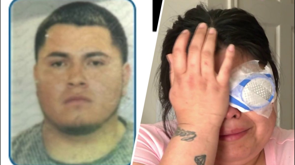 Man wanted for shooting woman in the face: Dallas Police – NBC 5 Dallas ...