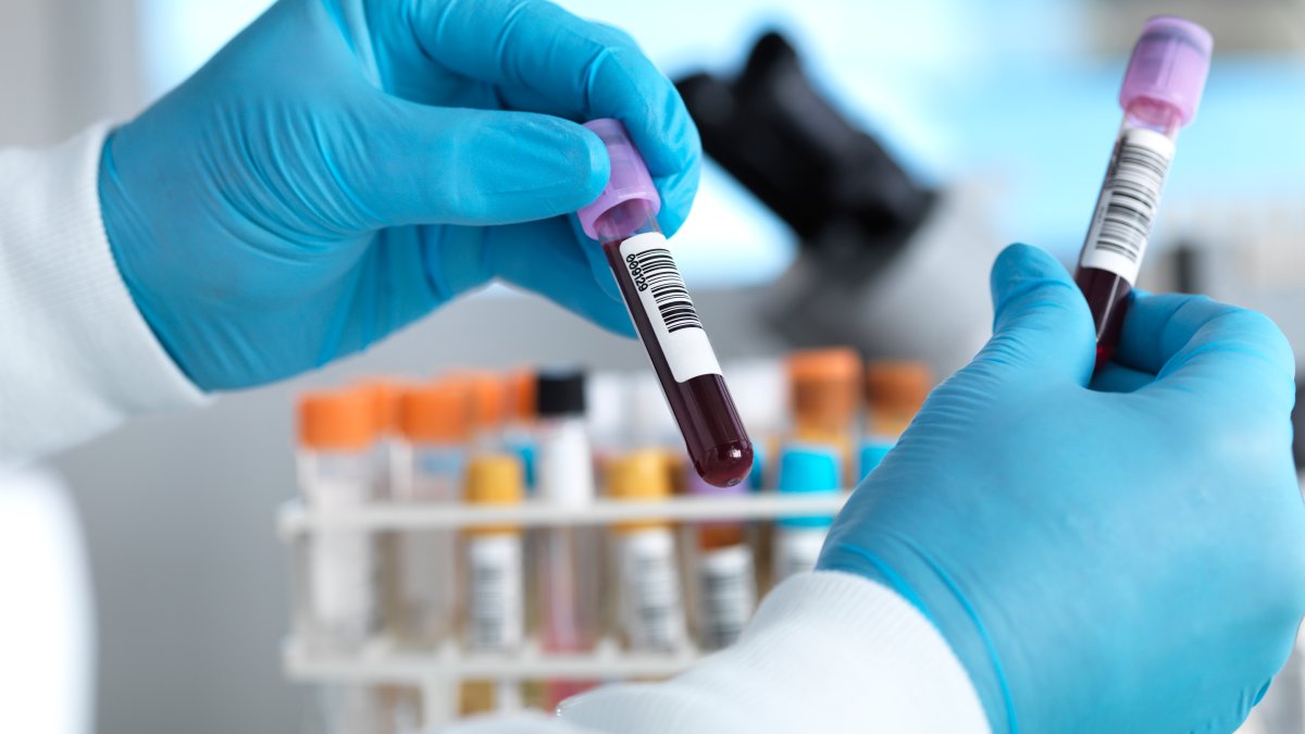 This blood test may predict heart disease better than 'bad' cholesterol.