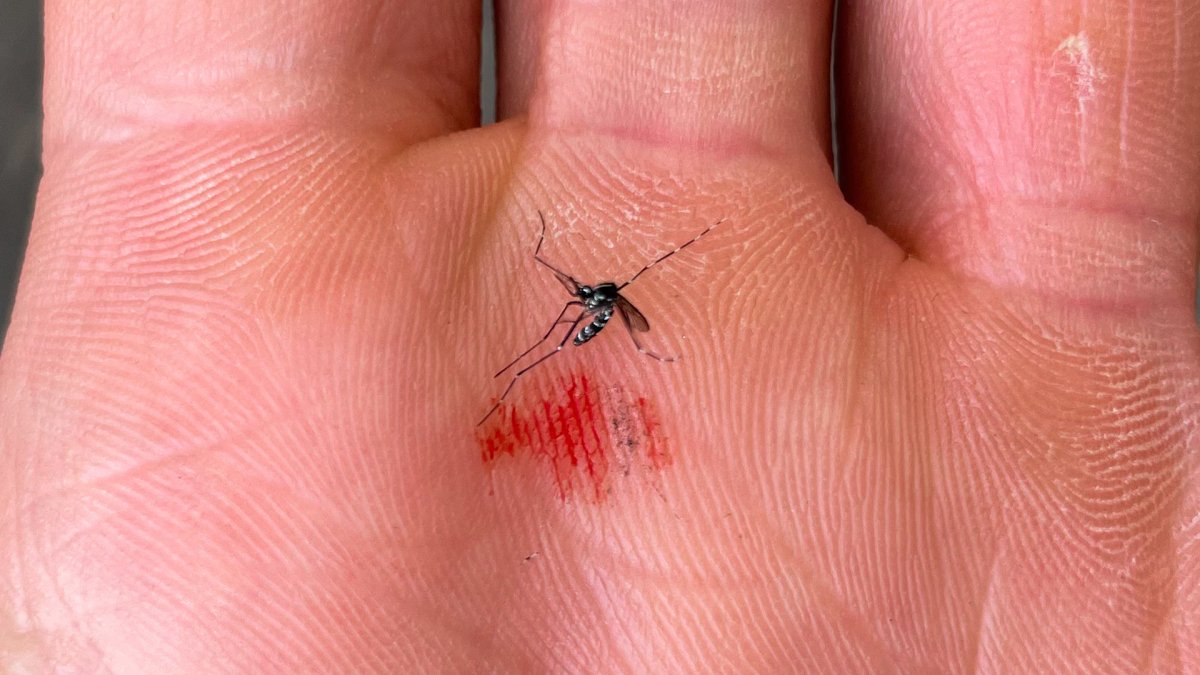 Denton reports first human case of West Nile virus of the season