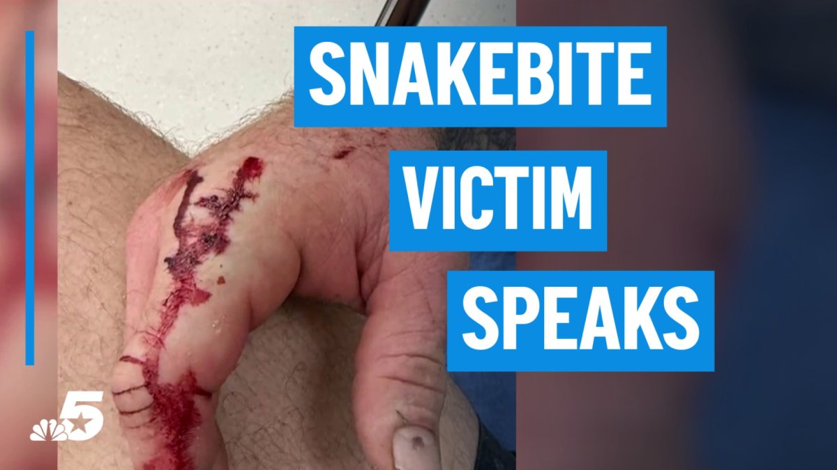Denton County snakebite victim has surprising reaction: “Don't get mad at a dog for wagging its tail.”