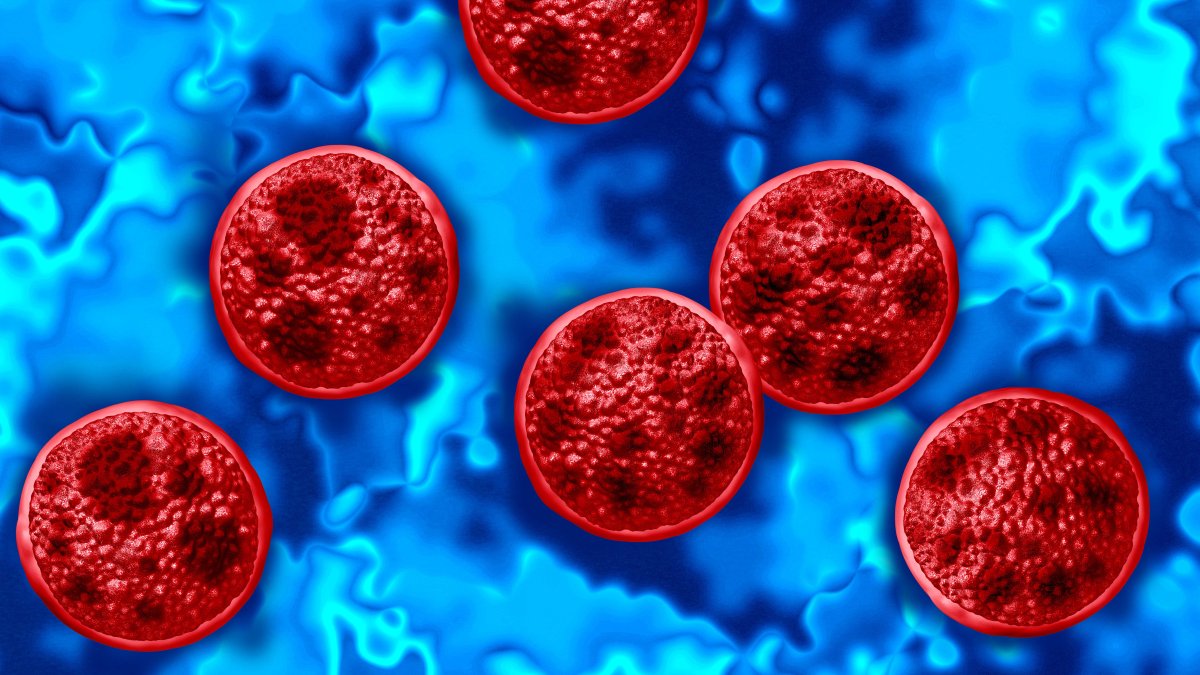 Michigan reports two deaths in cyclosporiasis outbreak