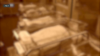 North Texas baby in surrogacy case undergoes open heart surgery, attorney says
