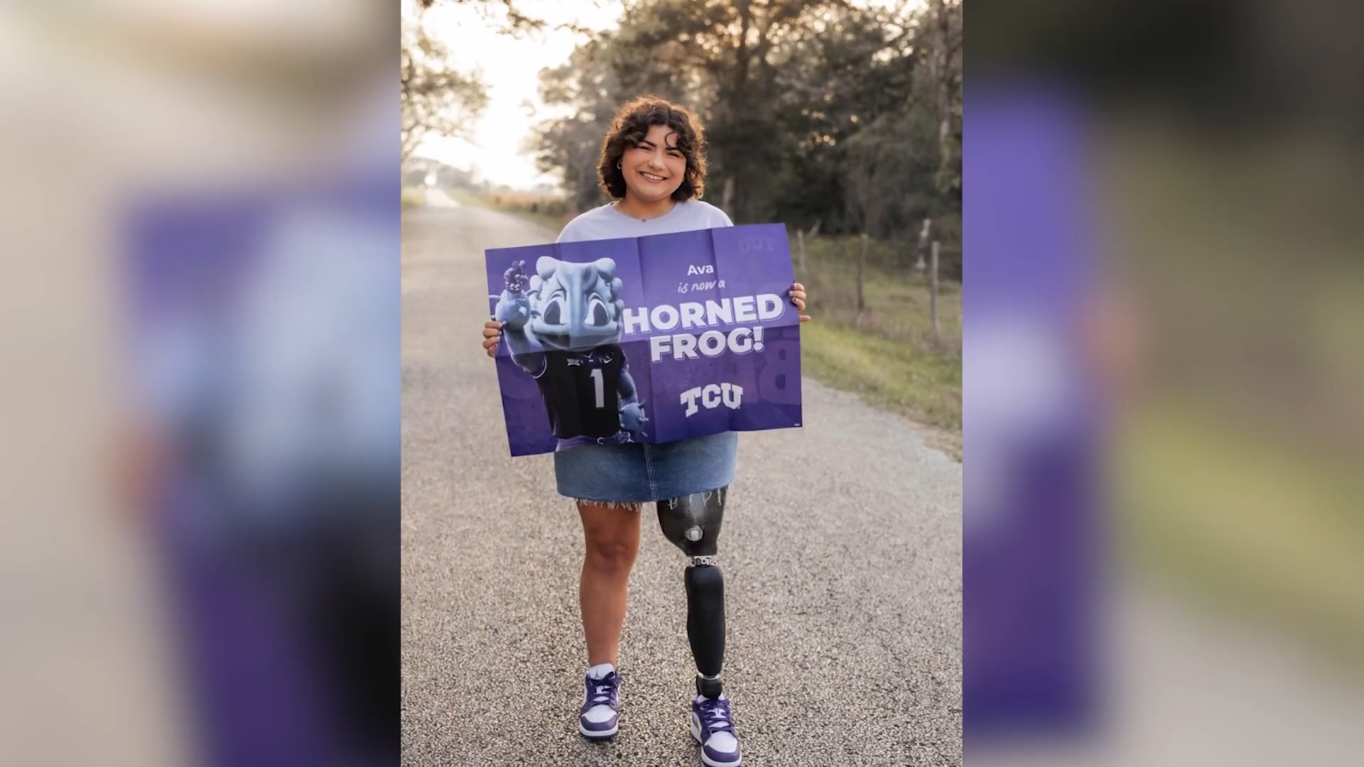 After losing leg to bone cancer, Texas teen returns to sports; starts college at TCU