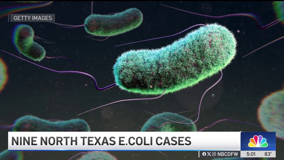 E. coli cases rise in North Texas as children become severely ill