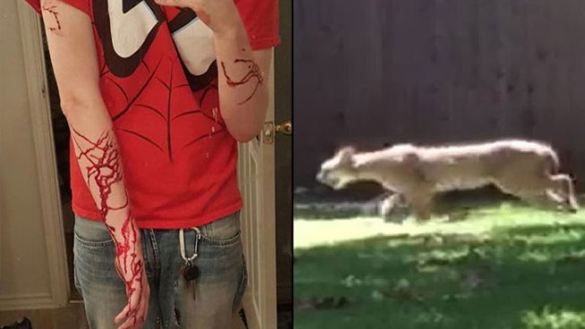 Plano Man Fights Off Bobcat During Dog Walk Nbc 5 Dallas Fort Worth