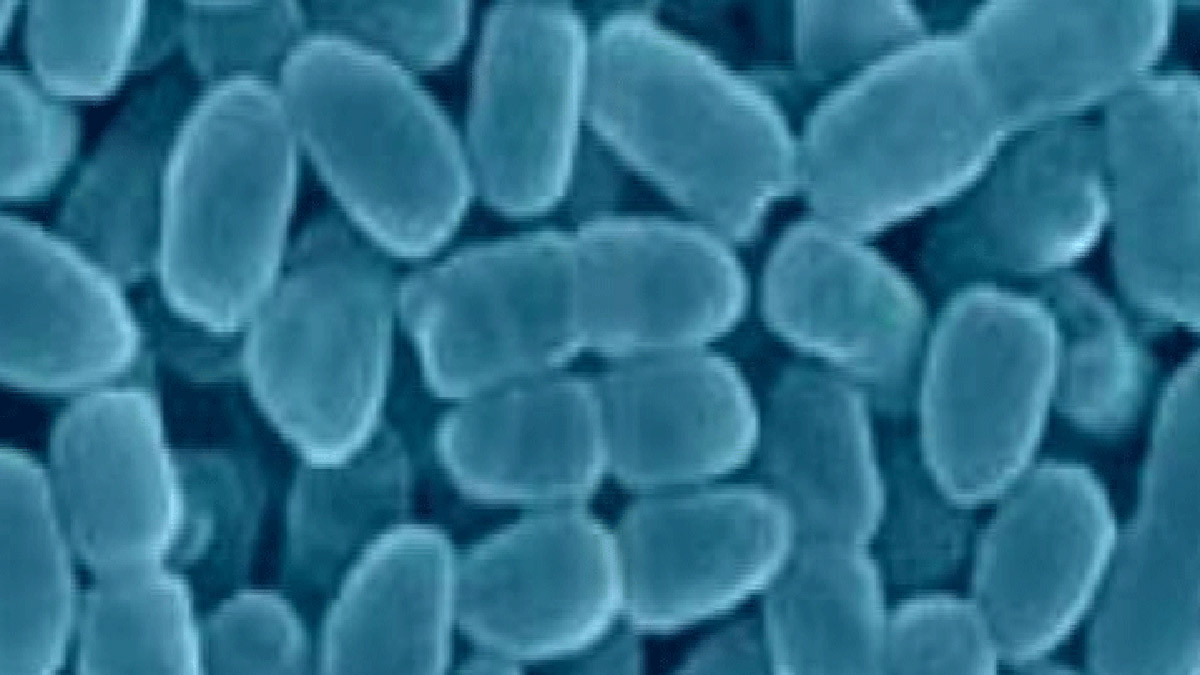Whooping Cough Confirmed in Grapevine-Colleyville ISD