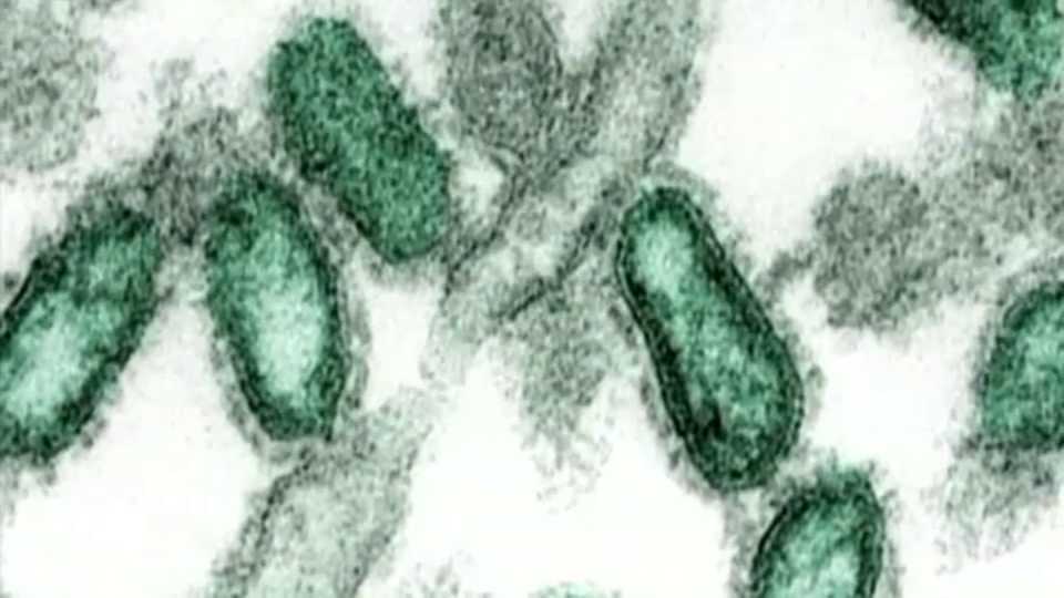 Denton County Confirms Third Flu-Related Fatality