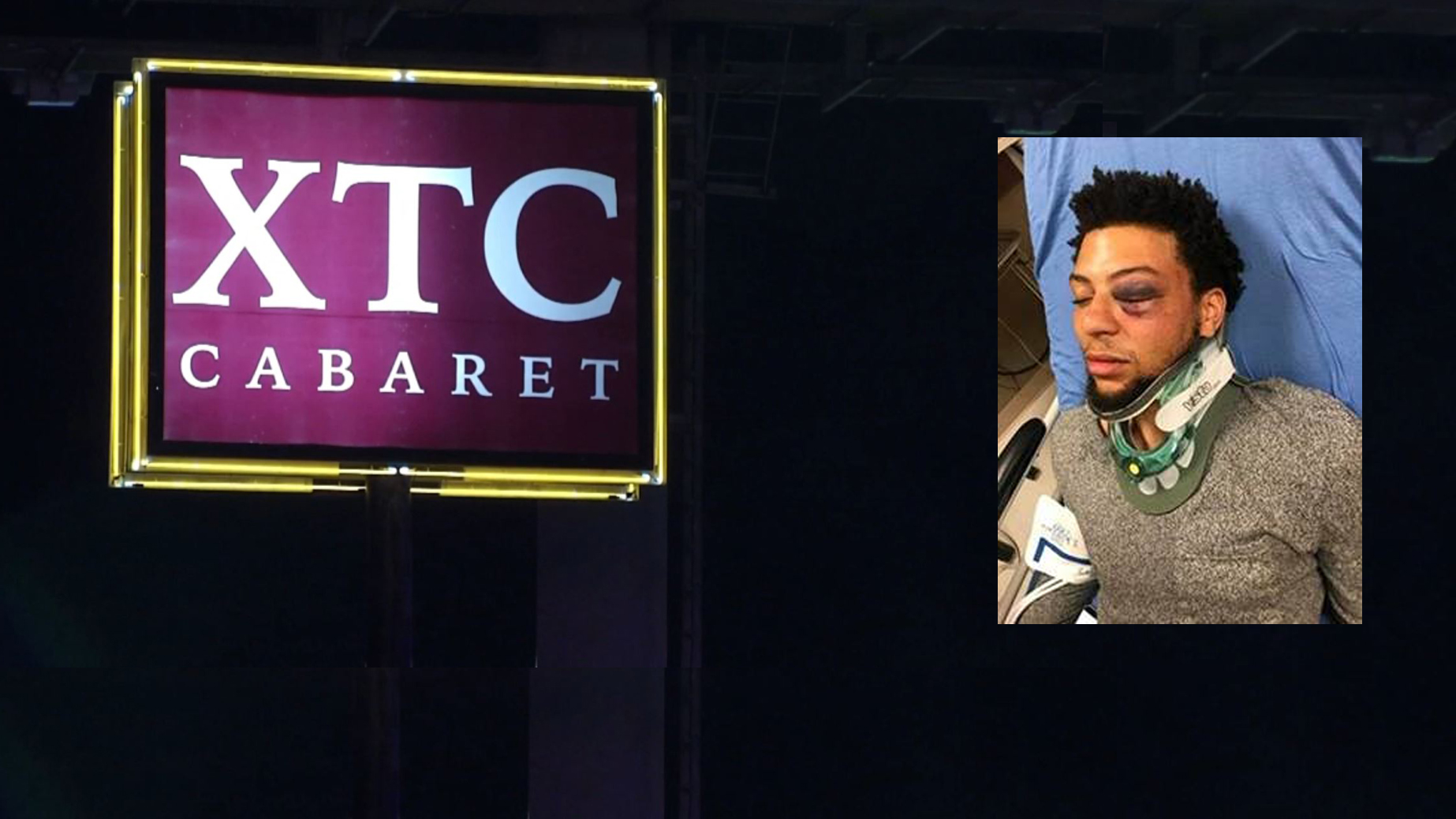 Man Says Guards at Strip Club Beat Him, Called Him N-Word